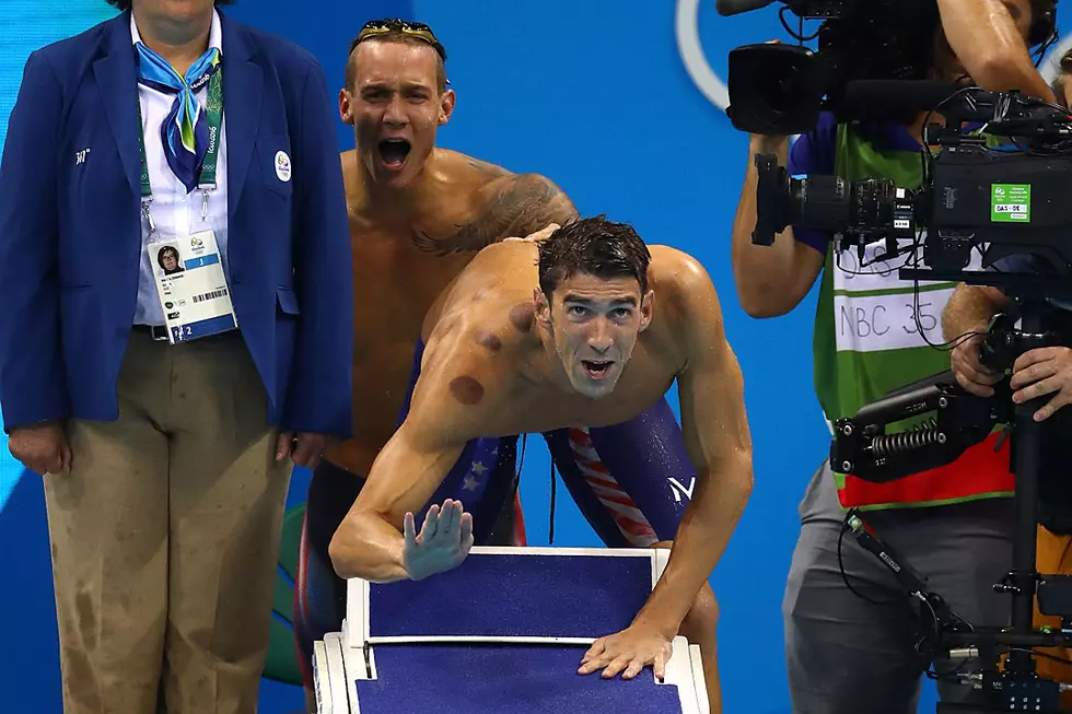 What the Heck Were Those Circles on Michael Phelps?